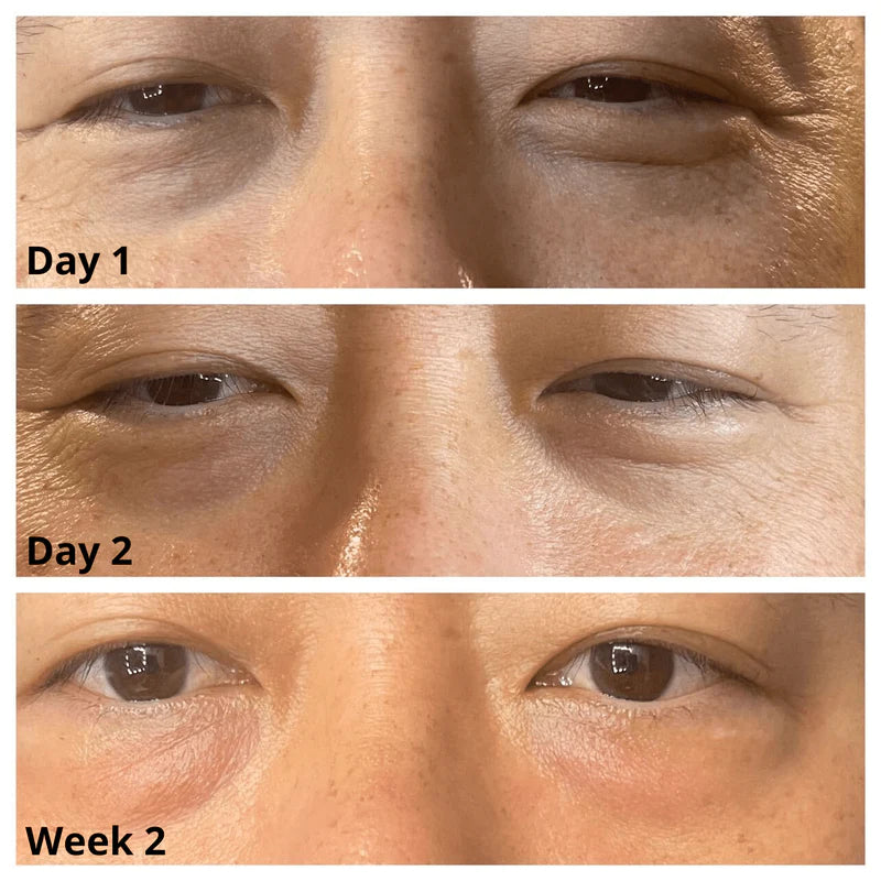Caffeine Eye Cream