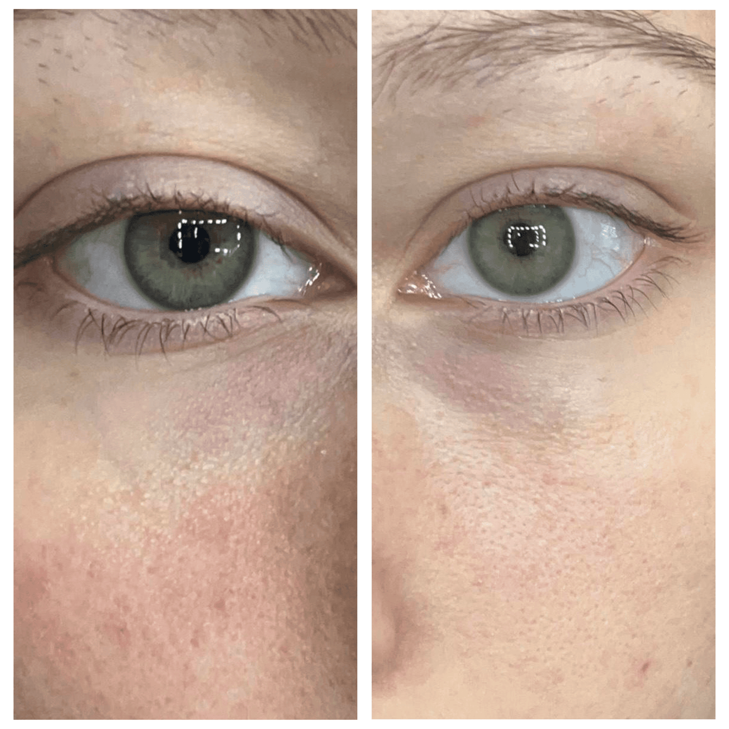 Caffeine Eye Cream